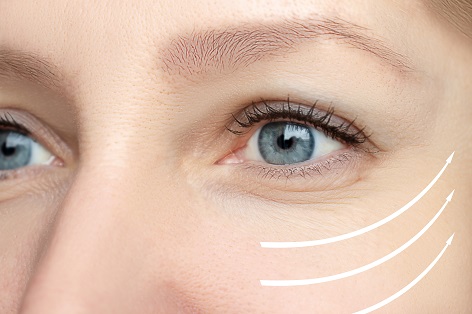 Peptidox® Eyes – für die empfindliche Haut um die Augenpartie